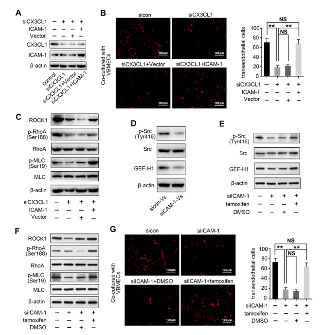 預(yù)防NSCLC脊柱轉(zhuǎn)移的潛在新靶點(diǎn)