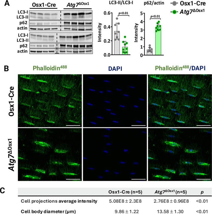 成骨細(xì)胞系細(xì)胞中的線粒體氧化應(yīng)激或自噬減少不足以模擬衰老對(duì)骨機(jī)械反應(yīng)性的有害影響