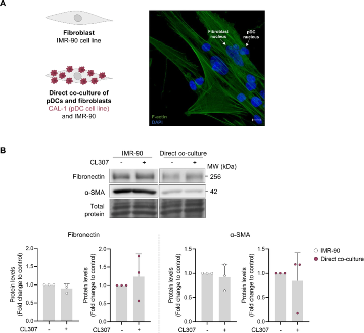 在漿細胞樣樹突狀細胞系中促進內(nèi)質(zhì)網(wǎng)應(yīng)激可驅(qū)動成纖維細胞活化