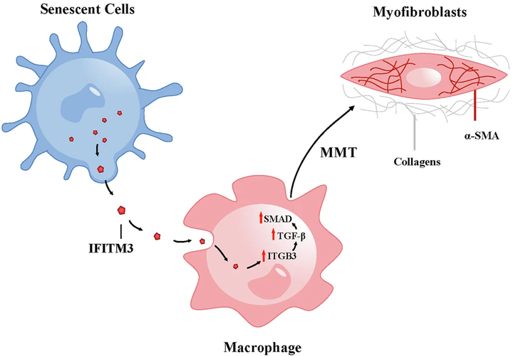 慢性缺血性腎病中細胞衰老促進巨噬細胞向肌成纖維細胞的轉(zhuǎn)變